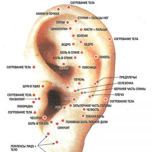 Плакат восточная медицина.Акупунктура уха